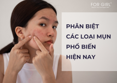 PHÂN BIỆT CÁC LOẠI MỤN PHỔ BIẾN HIỆN NAY