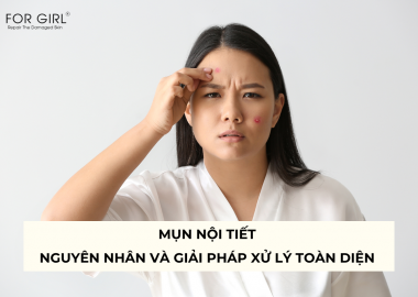 MỤN NỘI TIẾT - NGUYÊN NHÂN VÀ GIẢI PHÁP XỬ LÝ TOÀN DIỆN 