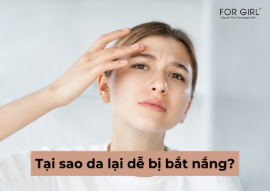 TẠI SAO DA HAY BỊ BẮT NẮNG VÀ GIẢI PHÁP TỐI ƯU