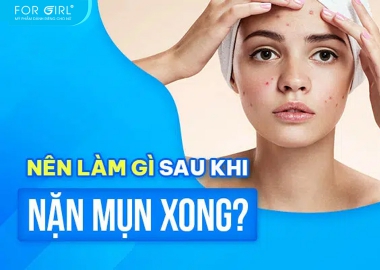 Nặn mụn xong nên làm gì? Hướng dẫn chăm sóc da sau nặn mụn